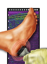 Foot-ultrasound